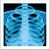X-Ray
