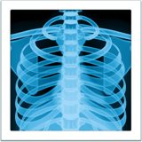 X-Ray on Apple