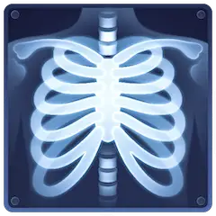 X-Ray on Facebook