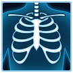 X-Ray on Samsung